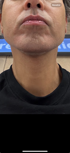 Photo from customer review