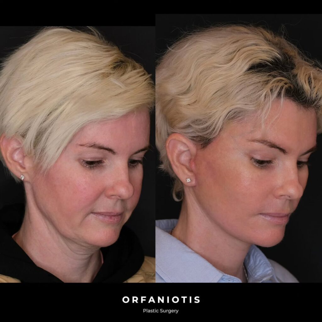 Instagram post from dr_georgios_orfaniotis. This post is in position 5.