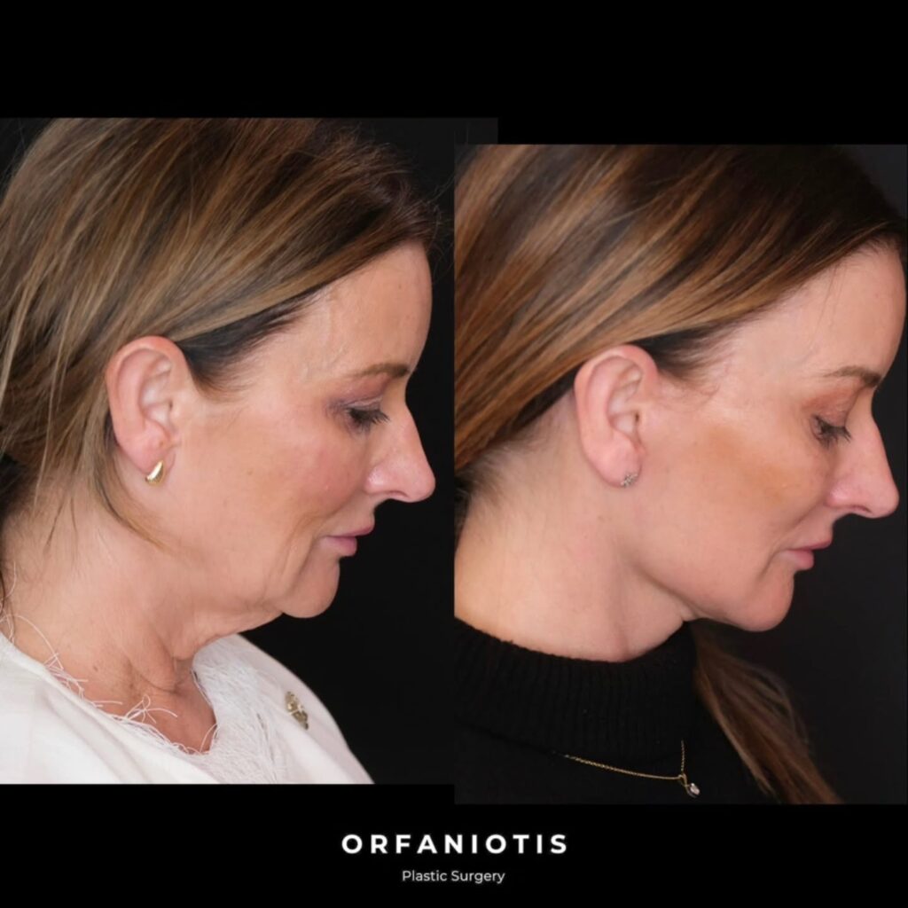 Instagram post from dr_georgios_orfaniotis. This post is in position 3.