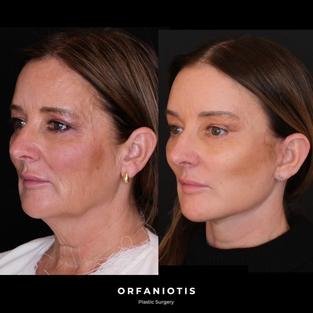 Instagram post from dr_georgios_orfaniotis. This post is in position 6.