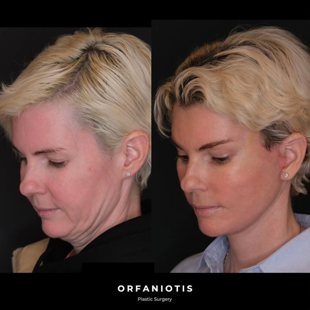 Instagram post from dr_georgios_orfaniotis. This post is in position 2.