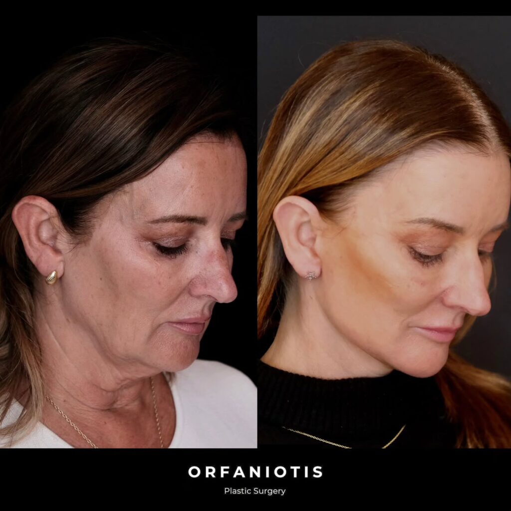 Instagram post from dr_georgios_orfaniotis. This post is in position 0.