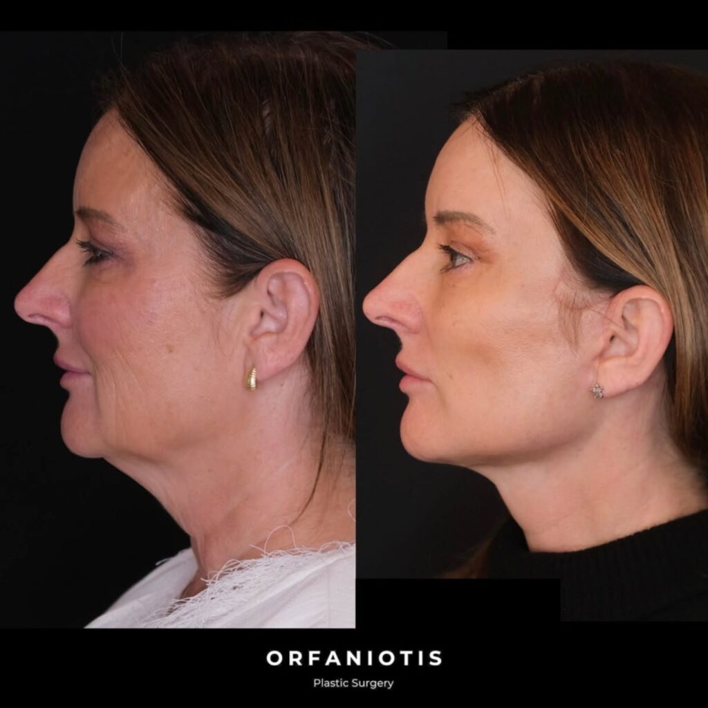 Instagram post from dr_georgios_orfaniotis. This post is in position 5.