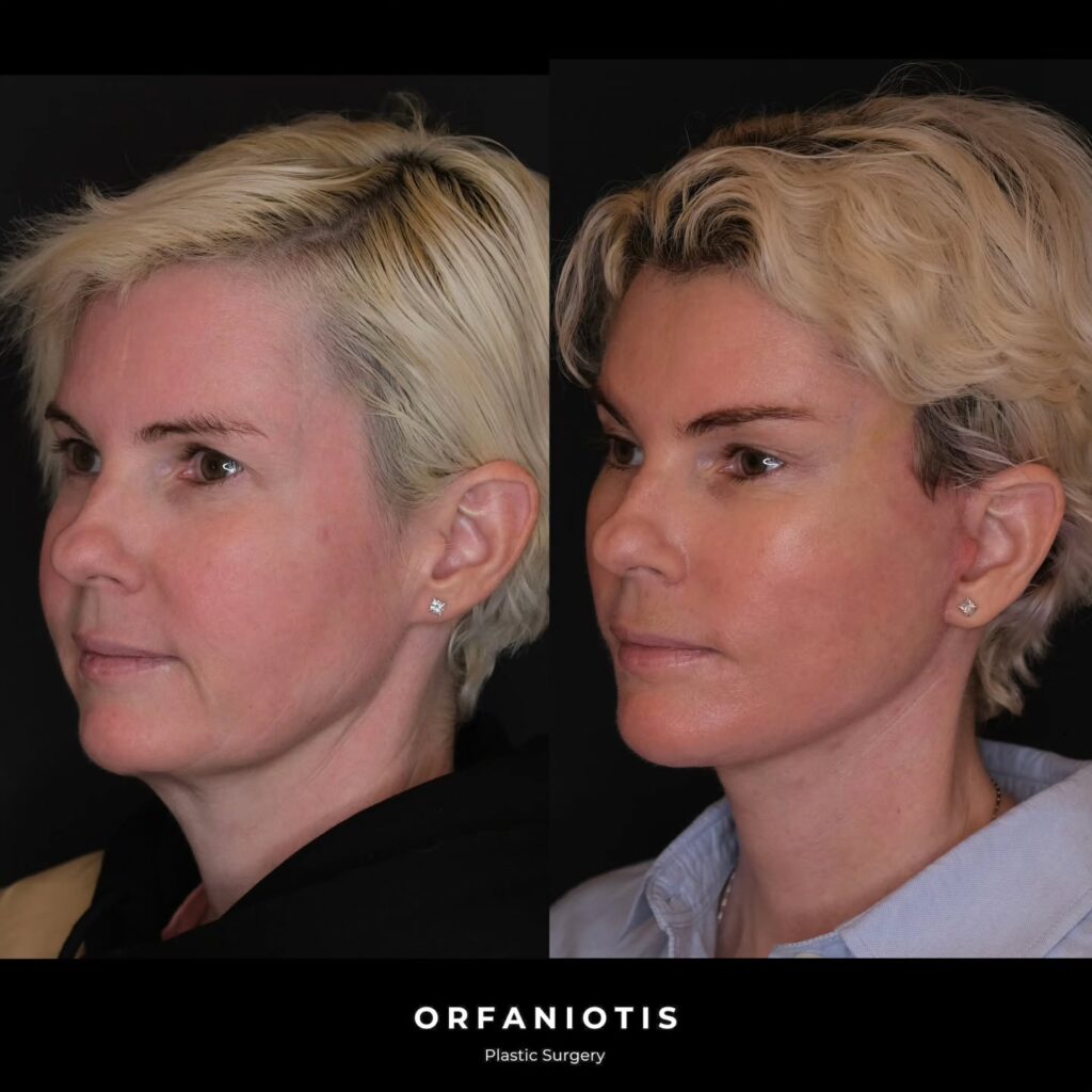 Instagram post from dr_georgios_orfaniotis. This post is in position 0.