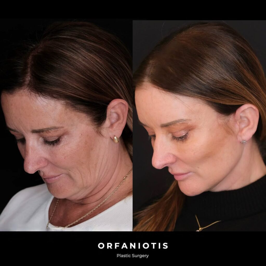 Instagram post from dr_georgios_orfaniotis. This post is in position 4.