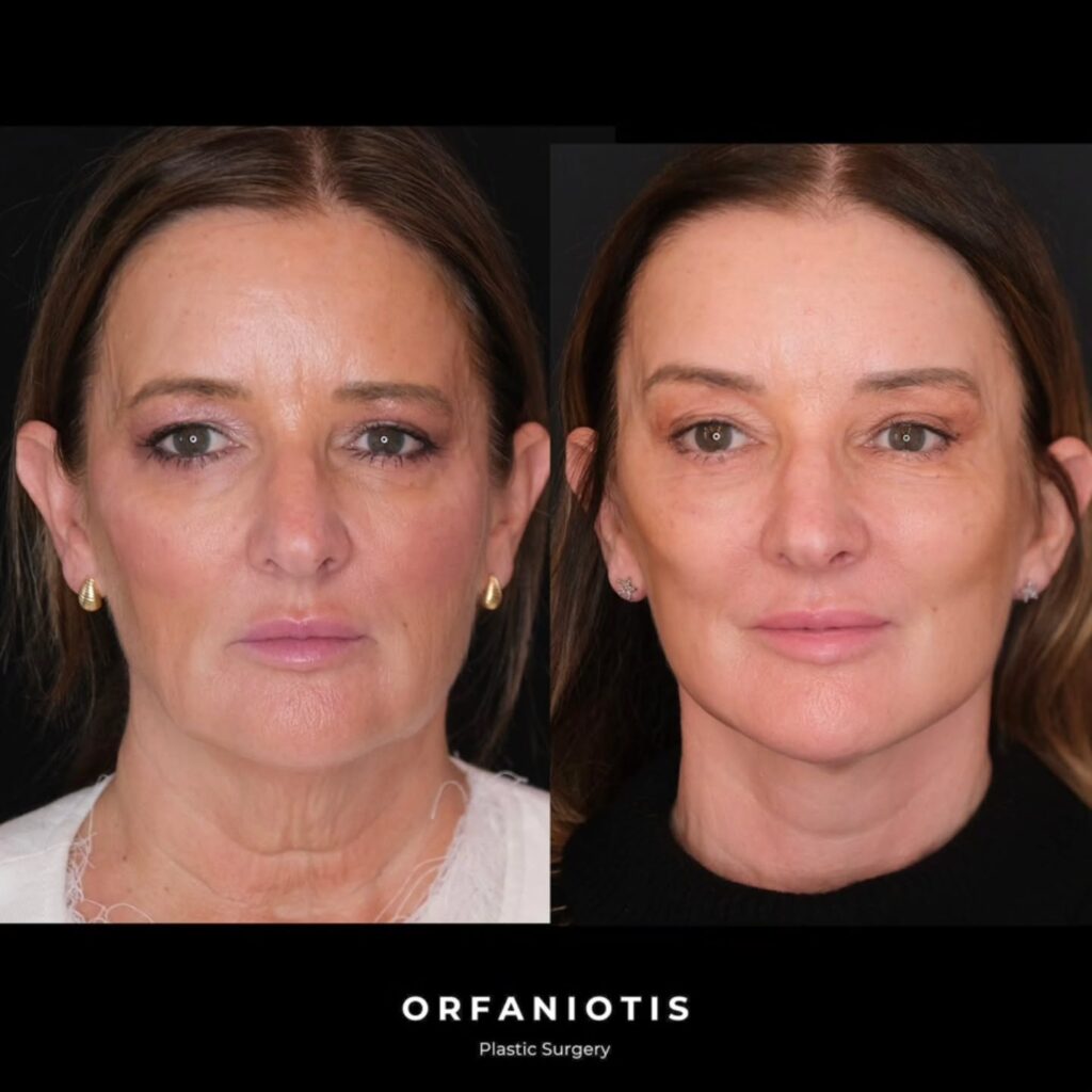 Instagram post from dr_georgios_orfaniotis. This post is in position 1.