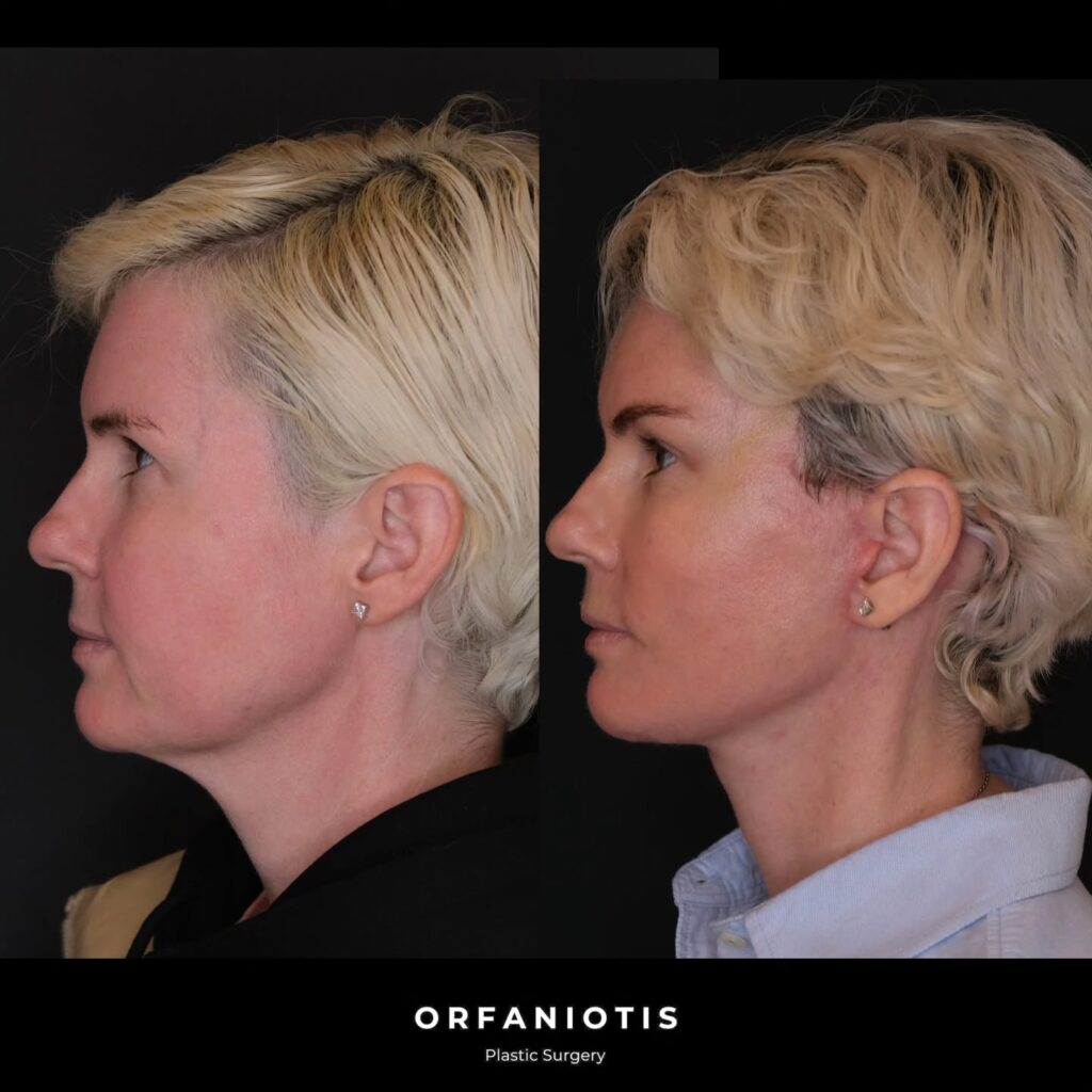 Instagram post from dr_georgios_orfaniotis. This post is in position 1.