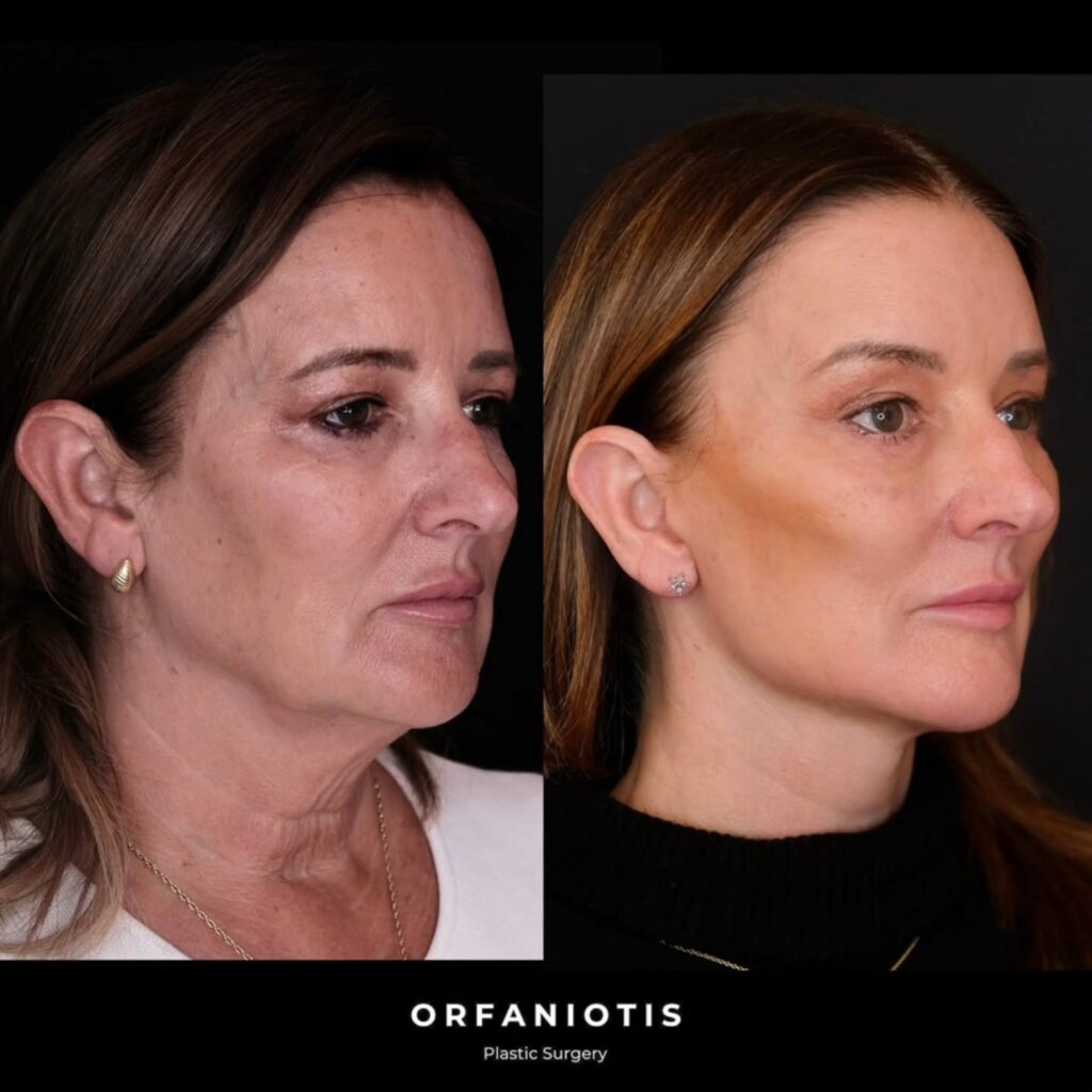 Instagram post from dr_georgios_orfaniotis. This post is in position 2.